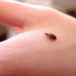 खटमलों का होगा जड़ से सफाया! किचन की इन चीजों के सामने नहीं टिक पाएंगे Bed Bugs, अभी आज़माएं ये रामबाण नुस्खे।