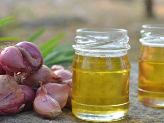 हेयर केयर टिप्स: ऐसे बनाएं प्याज का तेल, बालों के लिए है बेहद फायदेमंद