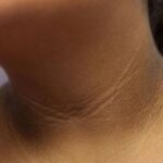 ब्यूटी टिप्स: गर्दन का कालापन दूर करेगा संतरे का छिलका, ऐसे करें इस्तेमाल