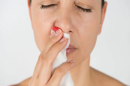 हेल्थ टिप्स: अगर नाक से बार-बार खून बहता है तो यह इस बीमारी का लक्षण हो सकता है।