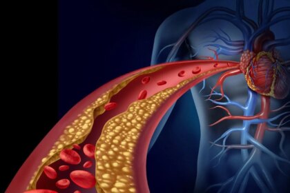 हेल्थ टिप्स: हाई कोलेस्ट्रॉल को कंट्रोल करने में उपयोगी हैं ये तीन खाद्य पदार्थ, अपनी डाइट में करें शामिल
